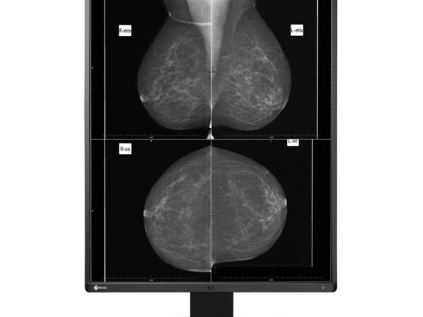 EIZO RadiForce GX560 Monitor PC 54,1 cm (21.3") 2048 x 2560 Pixel LCD Nero